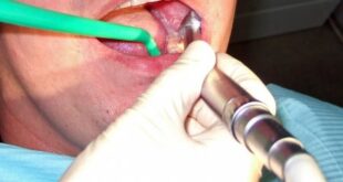 Названы основные причины появления неприятного запаха изо рта