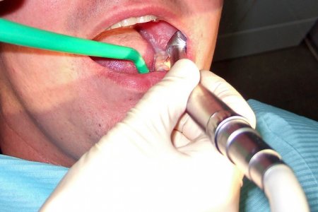 Названы основные причины появления неприятного запаха изо рта