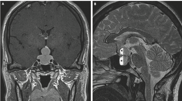 Дайджест интересных клинических случаев декабря