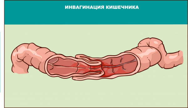 Причины рвоты у детей на море